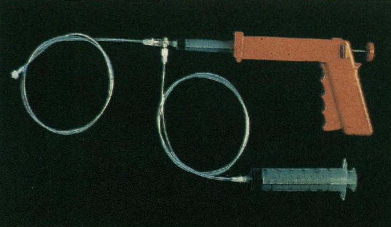 注射硬化壞死術(shù)